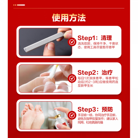 达克宁盐酸特比萘喷雾剂30ml